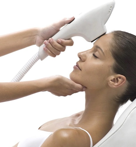 IPL Treatment Fredericton